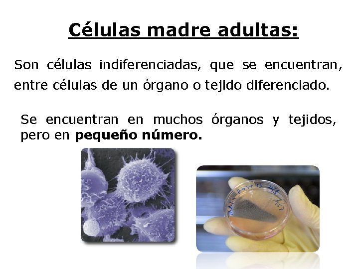 Células madre adultas: Son células indiferenciadas, que se encuentran, entre células de un órgano