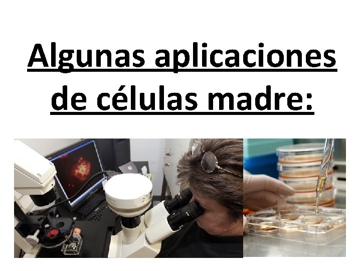 Algunas aplicaciones de células madre: 