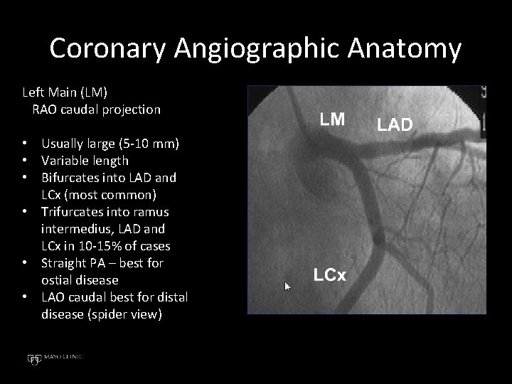 Coronary Angiographic Anatomy Left Main (LM) RAO caudal projection • Usually large (5 -10