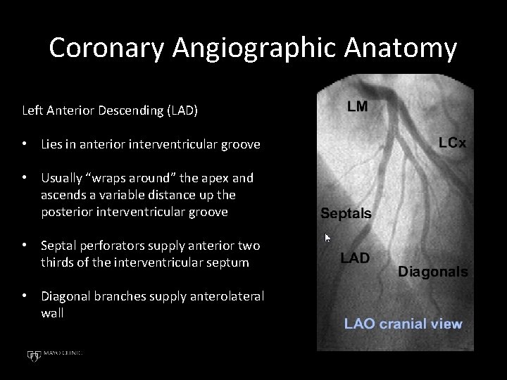 Coronary Angiographic Anatomy Left Anterior Descending (LAD) • Lies in anterior interventricular groove •