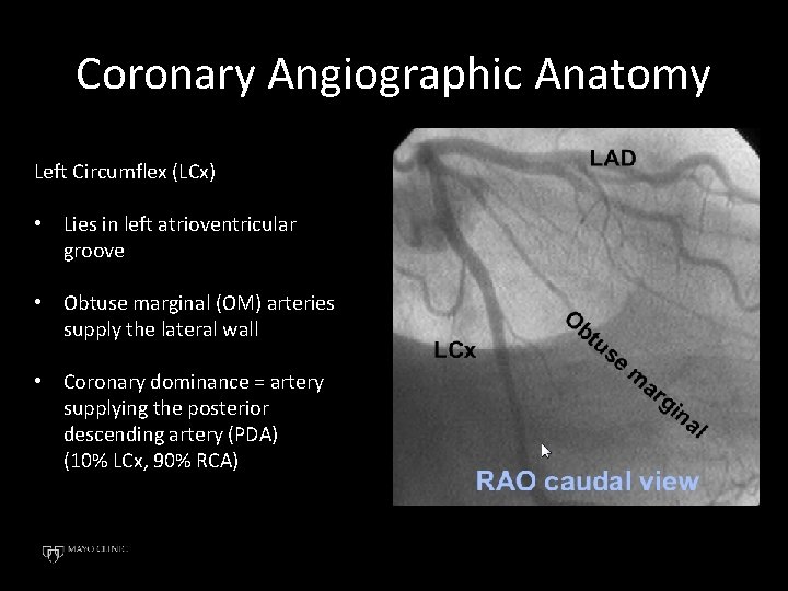 Coronary Angiographic Anatomy Left Circumflex (LCx) • Lies in left atrioventricular groove • Obtuse