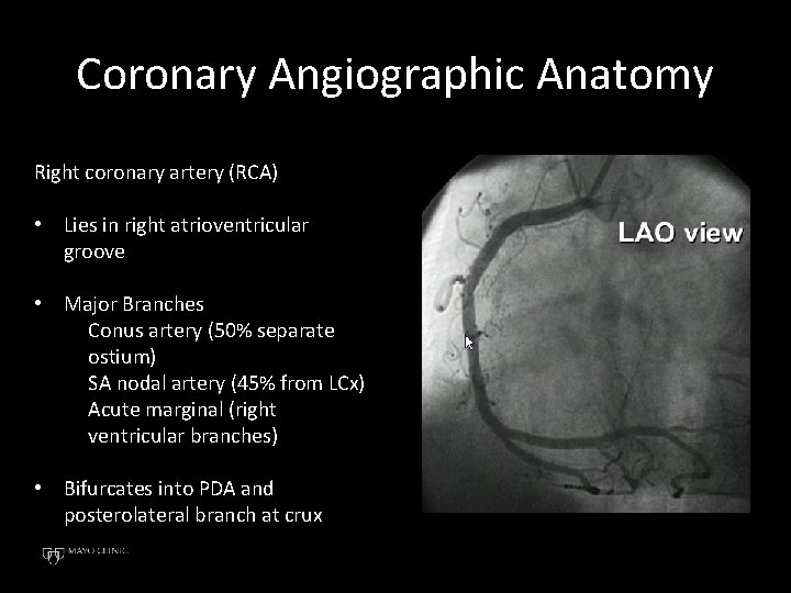 Coronary Angiographic Anatomy Right coronary artery (RCA) • Lies in right atrioventricular groove •