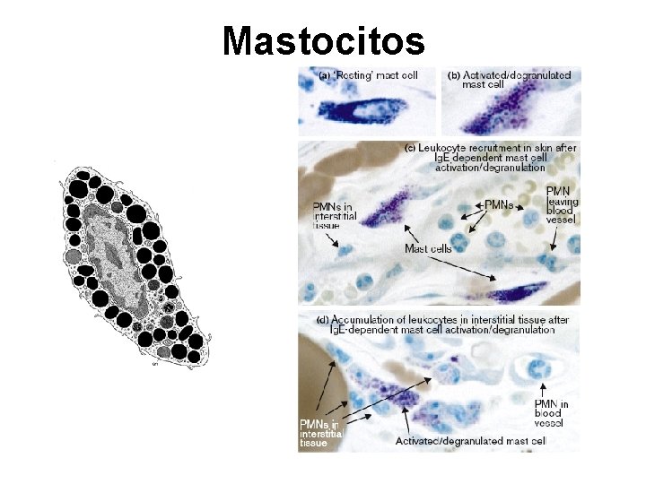 Mastocitos 