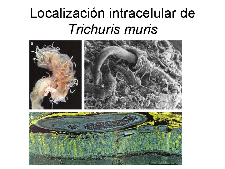 Localización intracelular de Trichuris muris 