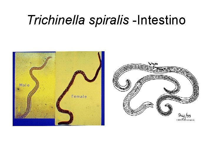 Trichinella spiralis -Intestino 