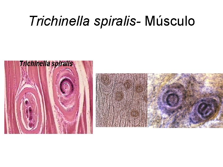 Trichinella spiralis- Músculo 