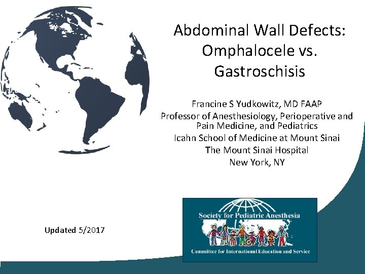 Abdominal Wall Defects: Omphalocele vs. Gastroschisis Francine S Yudkowitz, MD FAAP Professor of Anesthesiology,