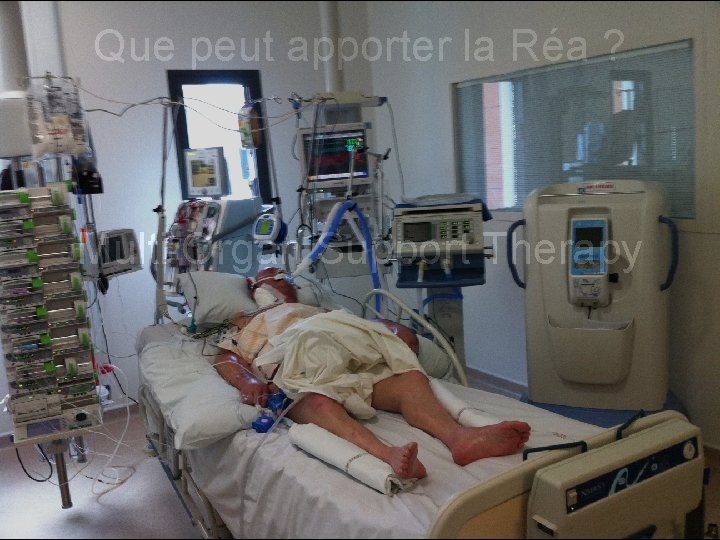 Que peut apporter la Réa ? Multi Organ Support Therapy 