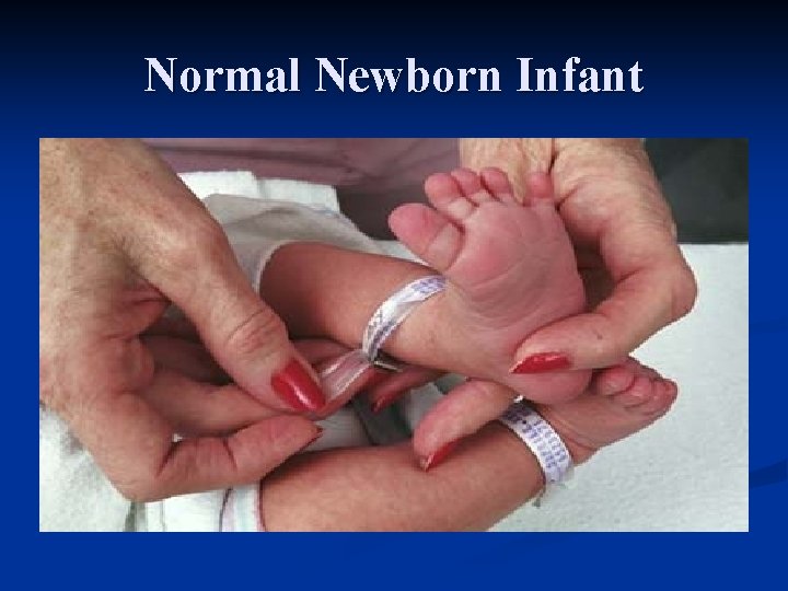 Normal Newborn Infant 