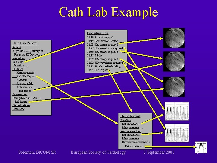 Cath Lab Example Procedure Log Cath Lab Report Patient 67 yr old male, history Cath Lab Example Procedure Log Cath Lab Report Patient 67 yr old male, history