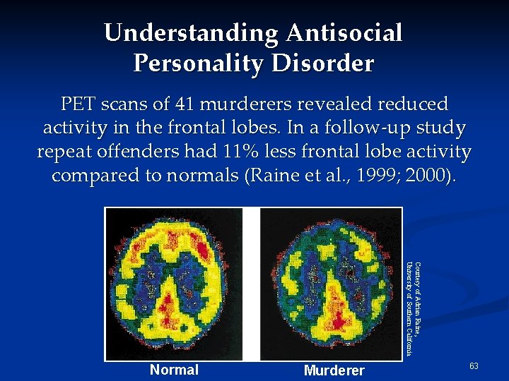 Understanding Antisocial Personality Disorder PET scans of 41 murderers revealed reduced activity in the Understanding Antisocial Personality Disorder PET scans of 41 murderers revealed reduced activity in the