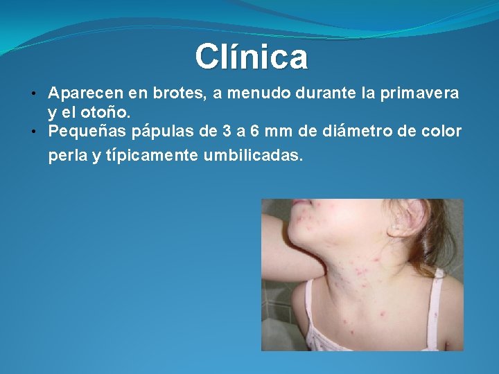 Clínica • Aparecen en brotes, a menudo durante la primavera y el otoño. •