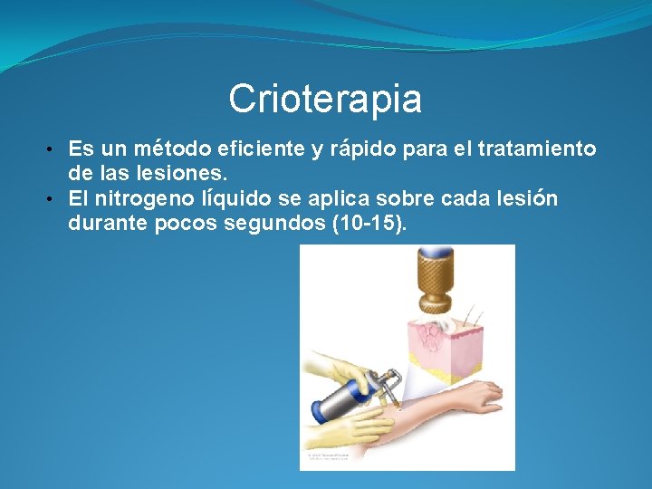 Crioterapia • Es un método eficiente y rápido para el tratamiento de las lesiones.