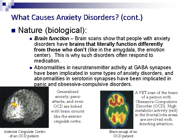 What Causes Anxiety Disorders? (cont. ) n Nature (biological): n n Brain function –