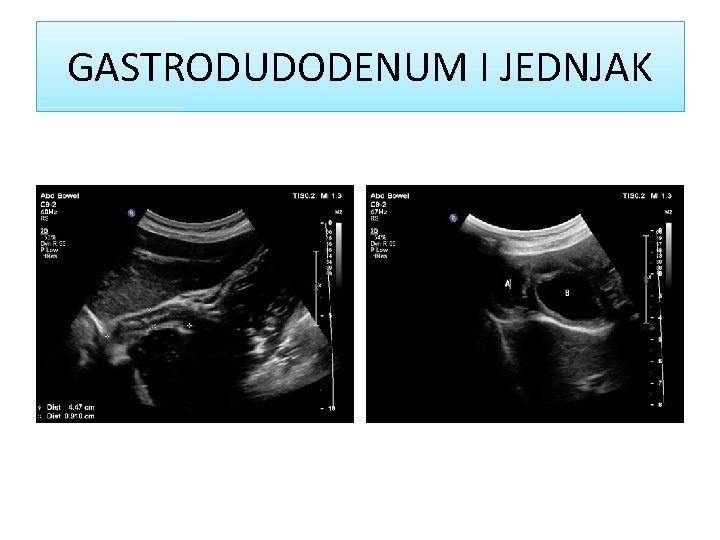 GASTRODUDODENUM I JEDNJAK 