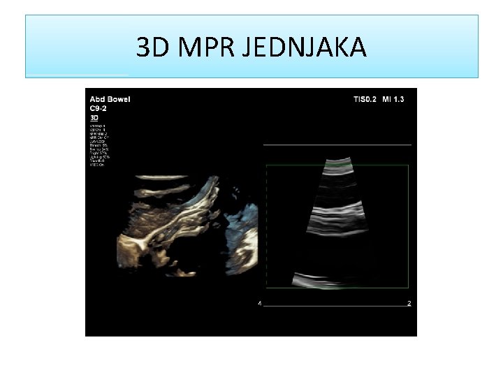 3 D MPR JEDNJAKA 