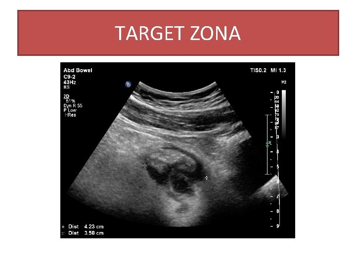 TARGET ZONA TARGET ZONA