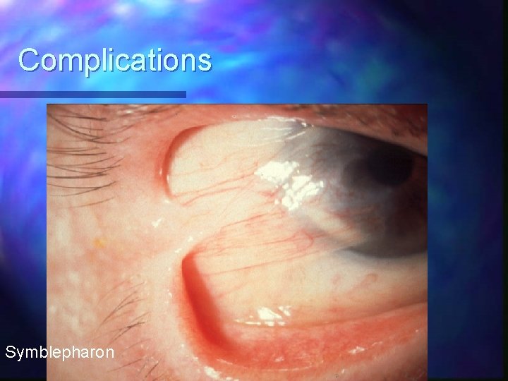 Complications Symblepharon 