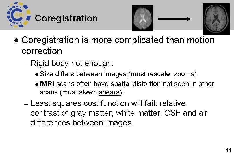 Coregistration l Coregistration is more complicated than motion correction – Rigid body not enough: