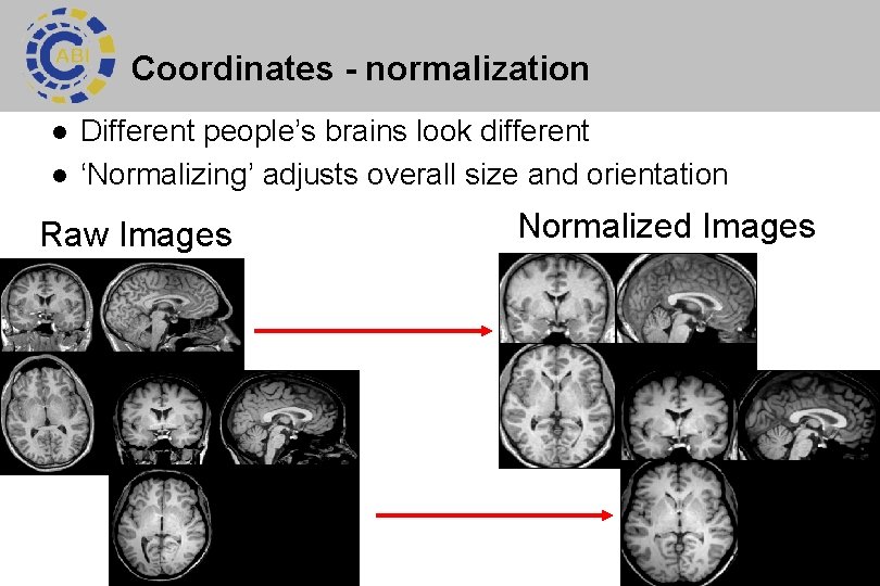 Coordinates - normalization l l Different people’s brains look different ‘Normalizing’ adjusts overall size