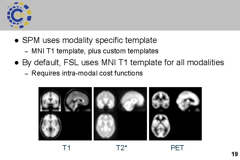 l SPM uses modality specific template – l MNI T 1 template, plus custom