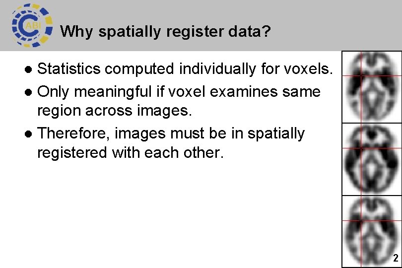 Why spatially register data? Statistics computed individually for voxels. l Only meaningful if voxel