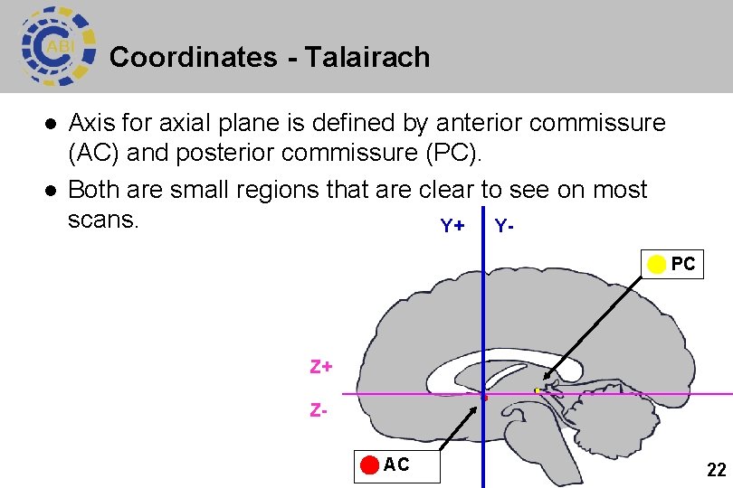 Coordinates - Talairach l l Axis for axial plane is defined by anterior commissure