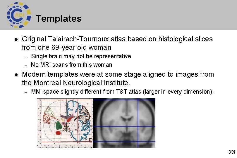 Templates l Original Talairach-Tournoux atlas based on histological slices from one 69 -year old