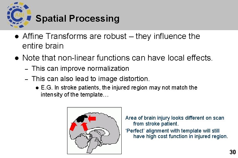 Spatial Processing l l Affine Transforms are robust – they influence the entire brain