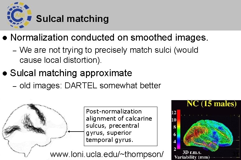 Sulcal matching l Normalization conducted on smoothed images. – l We are not trying