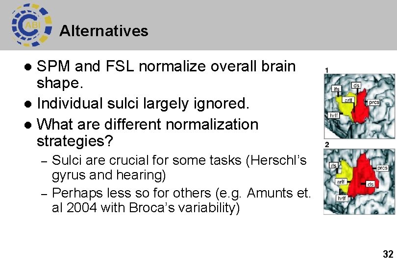 Alternatives SPM and FSL normalize overall brain shape. l Individual sulci largely ignored. l