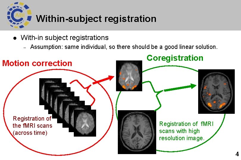 Within-subject registration l With-in subject registrations – Assumption: same individual, so there should be