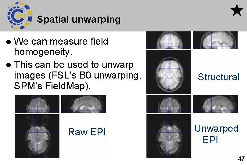 Spatial unwarping We can measure field homogeneity. l This can be used to unwarp