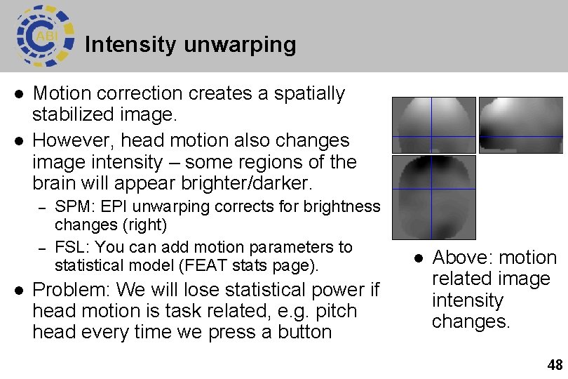 Intensity unwarping l l Motion correction creates a spatially stabilized image. However, head motion