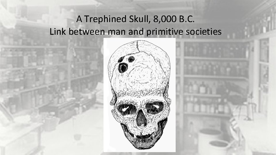 A Trephined Skull, 8, 000 B. C. Link between man and primitive societies 