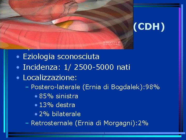 Ernia diaframmmatica (CDH) • • Sporadica Eziologia sconosciuta Incidenza: 1/ 2500 -5000 nati Localizzazione: