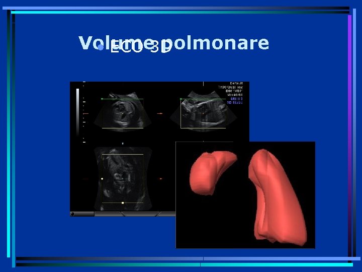 Volume polmonare • ECO 3 D 