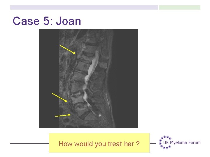 Case 5: Joan How would you treat her ? Case 5: Joan How would you treat her ?