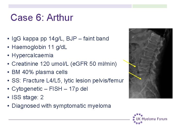 Case 6: Arthur • • • Ig. G kappa pp 14 g/L, BJP – Case 6: Arthur • • • Ig. G kappa pp 14 g/L, BJP –
