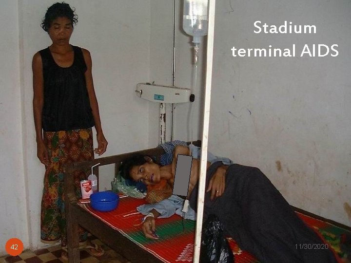 Stadium terminal AIDS 42 Tim Yandu Infus, RSMM 11/30/2020 