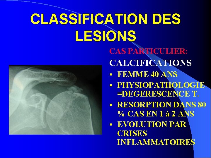 CLASSIFICATION DES LESIONS CAS PARTICULIER: CALCIFICATIONS FEMME 40 ANS § PHYSIOPATHOLOGIE =DEGERESCENCE T. §