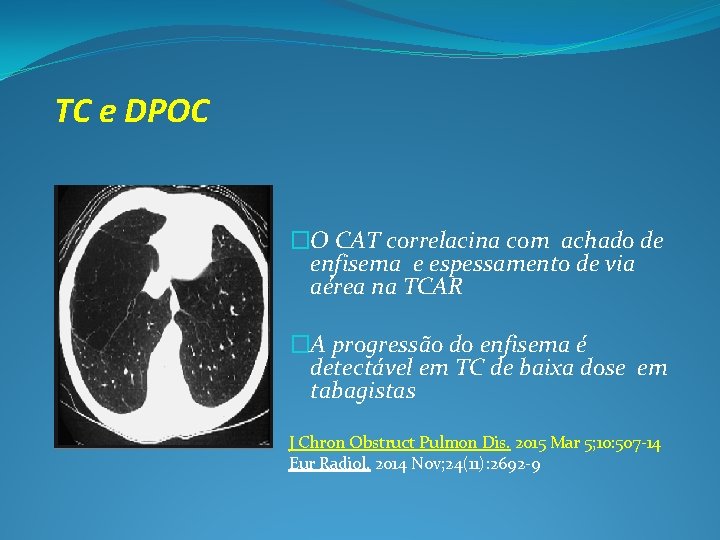 TC e DPOC �O CAT correlacina com achado de enfisema e espessamento de via