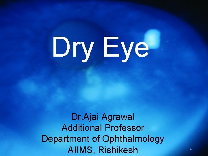 Dry Eye Dr. Ajai Agrawal Additional Professor Department of Ophthalmology AIIMS, Rishikesh 1 