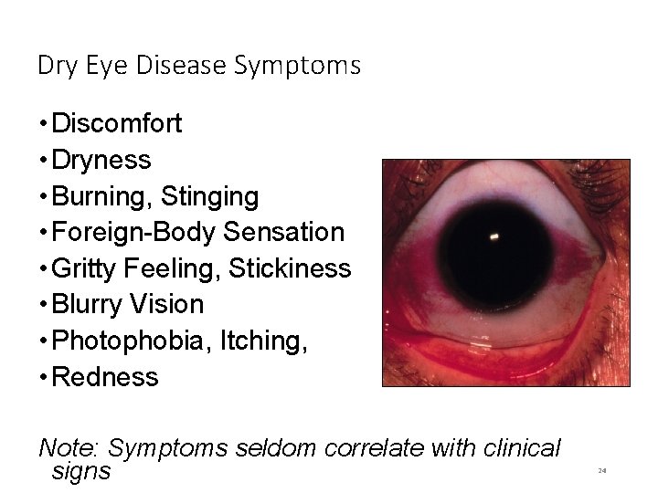 Dry Eye Disease Symptoms • Discomfort • Dryness • Burning, Stinging • Foreign-Body Sensation
