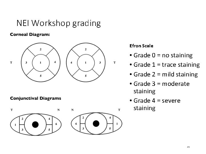NEI Workshop grading Efron Scale • Grade 0 = no staining • Grade 1