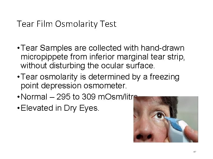 Tear Film Osmolarity Test • Tear Samples are collected with hand-drawn micropippete from inferior