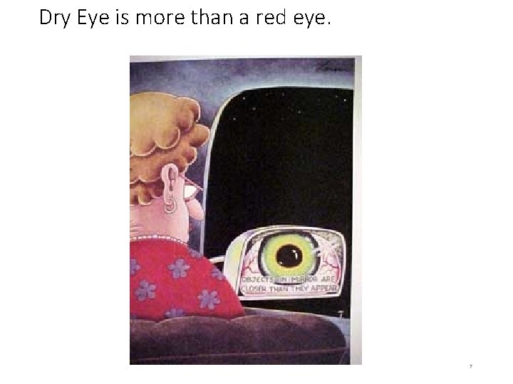 Dry Eye is more than a red eye. 7 