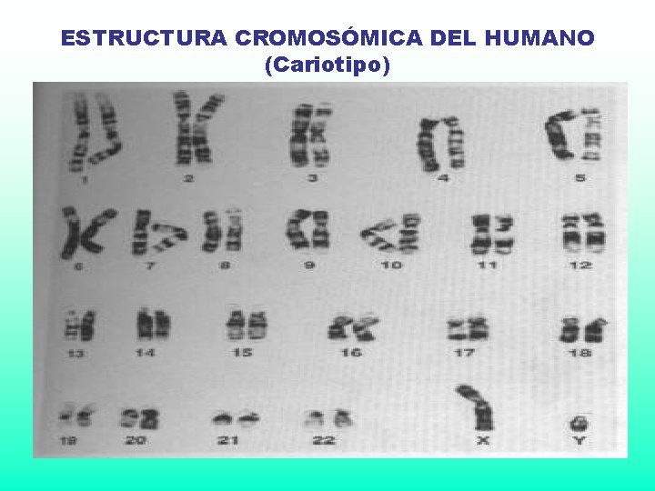 ESTRUCTURA CROMOSÓMICA DEL HUMANO (Cariotipo) ESTRUCTURA CROMOSÓMICA DEL HUMANO (Cariotipo)