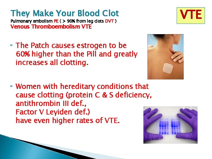 They Make Your Blood Clot Pulmonary embolism PE ( > 90% from leg clots