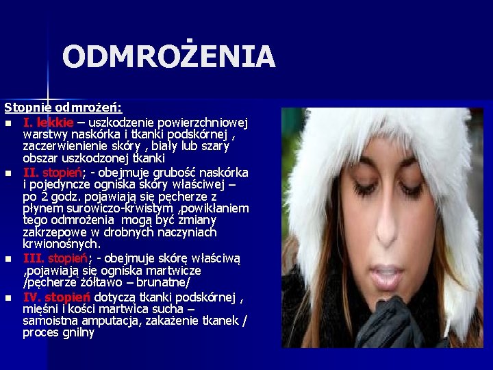 ODMROŻENIA Stopnie odmrożeń: n I. lekkie – uszkodzenie powierzchniowej warstwy naskórka i tkanki podskórnej